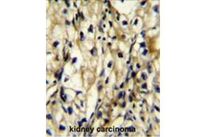 Immunohistochemistry (Paraffin-embedded Sections) (IHC (p)) image for anti-Branched Chain Amino-Acid Transaminase 1, Cytosolic (BCAT1) (AA 88-115), (Middle Region) antibody (ABIN950617)
