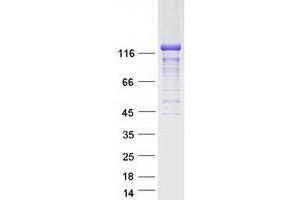 Western Blotting (WB) image for StAR-Related Lipid Transfer (START) Domain Containing 13 (STARD13) protein (Myc-DYKDDDDK Tag) (ABIN2732761)
