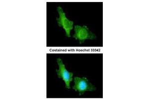 ICC/IF Image Immunofluorescence analysis of methanol-fixed HeLa, using CNGA2, antibody at 1:200 dilution. (CNGA2 抗体  (C-Term))