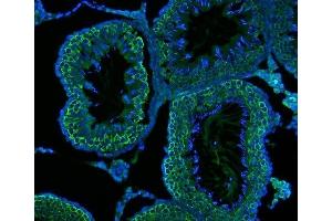 anti-DEAD Box Protein 4 (DDX4) (AA 3-666) antibody