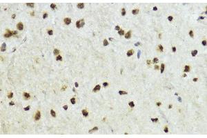 Immunohistochemistry of paraffin-embedded Mouse brain using Phospho-Histone H3(T11) Polyclonal Antibody at dilution of 1:100 (40x lens).