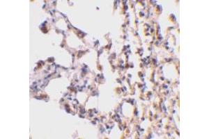 Immunohistochemical staining of mouse lung tissue using AP30147PU-N Bid antibody at 2 μg/ml.