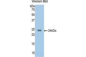 Western blot analysis of the recombinant protein. (NAGA 抗体  (AA 218-411))