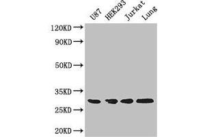 Western Blot Positive WB detected in: U87 whole cell lysate, HEK293 whole cell lysate, Jurkat whole cell lysate, Mouse lung tissue All lanes: LASP1 antibody at 4 μg/mL Secondary Goat polyclonal to rabbit IgG at 1/50000 dilution Predicted band size: 30, 37, 24 kDa Observed band size: 30 kDa