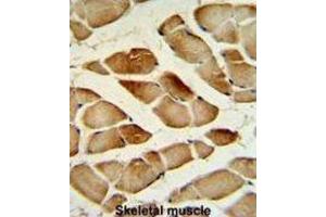 Immunohistochemistry (IHC) image for anti-Cathepsin F (CTSF) antibody (ABIN3002689) (Cathepsin F 抗体)