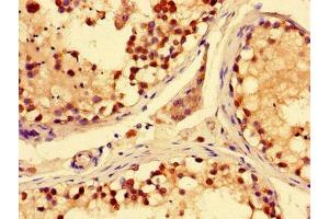 Immunohistochemistry (IHC) image for anti-Solute Carrier Family 28 (Sodium-Coupled Nucleoside Transporter), Member 3 (SLC28A3) (AA 1-102) antibody (ABIN7170219)