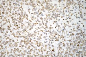 anti-Hexamethylene Bis-Acetamide Inducible 1 (HEXIM1) antibody