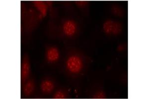 Image no. 3 for anti-Forkhead Box O4 (FOXO4) (pSer197) antibody (ABIN196850) (FOXO4 抗体  (pSer197))