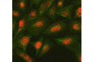 IF analysis of SMC2 and Tubulin beta using anti-SMC2 antibody (ABIN7601453) and anti-Tubulin beta antibody (ABIN7602744). (SMC2 抗体  (AA 359-1071))