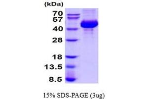 SDS-PAGE (SDS) image for Cathepsin L1 (CTSL1) (AA 18-334) protein (His tag) (ABIN6387773)