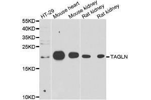 Western blot analysis of extracts of various cell lines, using TAGLN antibody. (Transgelin 抗体  (AA 1-201))