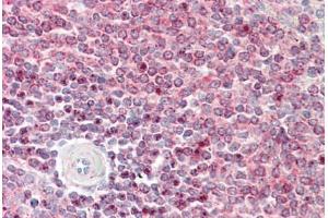 Human Spleen: Formalin-Fixed, Paraffin-Embedded (FFPE) (IST1 抗体  (AA 125-317))