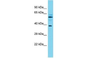 Host: Rabbit Target Name: MACROD1 Sample Type: Fetal Brain lysates Antibody Dilution: 1. (MACROD1 抗体  (N-Term))