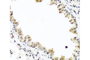 Immunohistochemistry of paraffin-embedded Mouse lung using TET2 Polyclonal Antibody at dilution of 1:100 (40x lens). (TET2 抗体)