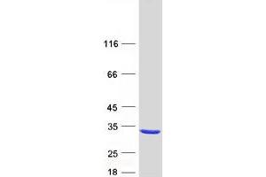 Western Blotting (WB) image for RAB37, Member RAS Oncogene Family (RAB37) (Transcript Variant 3) protein (Myc-DYKDDDDK Tag) (ABIN2730343)