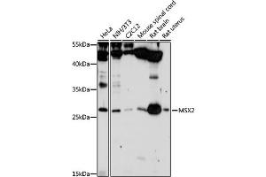 Western blot analysis of extracts of various cell lines, using MSX2 antibody (ABIN3015838, ABIN3015839, ABIN3015840 and ABIN6219185) at 1:1000 dilution. (Msx2/Hox8 抗体  (AA 1-267))