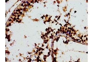 Immunohistochemistry of paraffin-embedded human testis tissue using ABIN7148001 at dilution of 1:100 (F13A1 抗体  (AA 380-520))