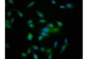 Immunofluorescence staining of Hela cells with ABIN7161047 at 1:166, counter-stained with DAPI. (NRD1 抗体  (AA 32-113))