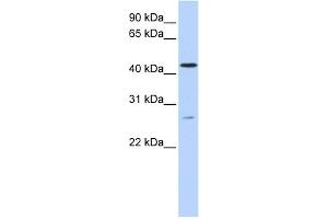 WB Suggested Anti-ACBD5 Antibody Titration:  0. (ACBD5 抗体  (C-Term))