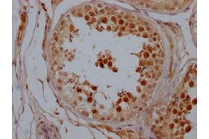 IHC image of ABIN7127809 diluted at 1:100 and staining in paraffin-embedded human testis tissue performed on a Leica BondTM system. (Recombinant SIRT1 抗体)