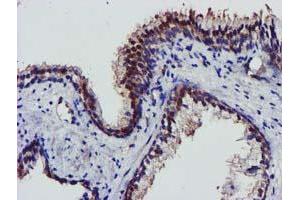 Image no. 5 for anti-V-Akt Murine Thymoma Viral Oncogene Homolog 1 (AKT1) antibody (ABIN1496559) (AKT1 抗体)