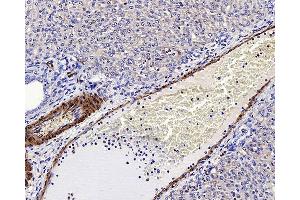 Immunohistochemistry analysis of paraffin-embedded rat liver using LDLR Polyclonal Antibody at dilution of 1:300. (LDLR 抗体)