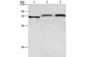 Western Blot analysis of Hela cell, Human fetal brain and hepatocellular carcinoma tissue using RDX Polyclonal Antibody at dilution of 1:700 (Radixin 抗体)