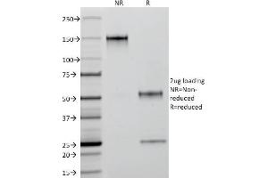 SDS-PAGE (SDS) image for anti-Keratin 18 (KRT18) antibody (ABIN6939935)