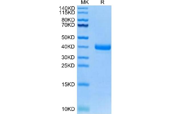 Tissue factor Protein (AA 35-248) (His tag)