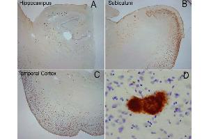 Extensive OC labeling was observed in the hippocampus (A), subiculum (B) and frontal cortex (C) in Alzheimer disease. (Amyloid Fibrils 抗体)