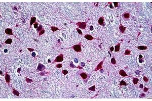 Human Brain, Cortex: Formalin-Fixed, Paraffin-Embedded (FFPE) (SFPQ 抗体  (AA 269-362))