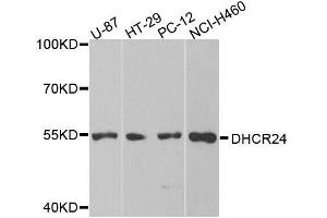 Western blot analysis of extracts of various cell lines, using DHCR24 antibody. (Seladin 1 抗体  (AA 227-516))