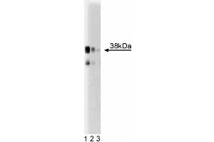 Western blot analysis of serine racemase in a mouse cerebrum lysate. (SRR 抗体  (AA 127-248))