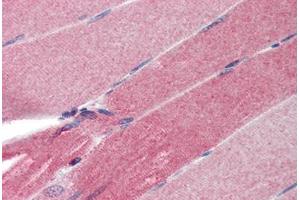 Human Skeletal Muscle (formalin-fixed, paraffin-embedded) stained with FHL1 antibody ABIN462171 followed by biotinylated goat anti-rabbit IgG secondary antibody ABIN481713, alkaline phosphatase-streptavidin and chromogen. (FHL1 抗体  (AA 51-100))
