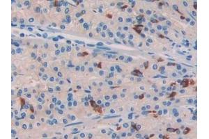 Immunohistochemistry (IHC) image for anti-Collagen, Type III, alpha 1 (COL3A1) (AA 1171-1435) antibody (ABIN7435409)