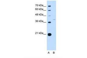 Image no. 1 for anti-Replication Factor C (Activator 1) 3, 38kDa (RFC3) (AA 91-140) antibody (ABIN6738211) (RFC3 抗体  (AA 91-140))