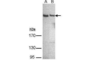WB Image Sample (30 ug of whole cell lysate) A: A431 , B: Hep G2 , 5% SDS PAGE antibody diluted at 1:500 (PLCH1 抗体)