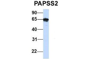 Western Blotting (WB) image for anti-3'-phosphoadenosine 5'-phosphosulfate Synthase 2 (PAPSS2) (C-Term) antibody (ABIN2783448)