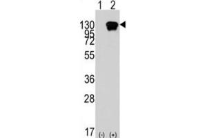 Western Blotting (WB) image for anti-Receptor Tyrosine Kinase-Like Orphan Receptor 1 (ROR1) antibody (ABIN2924492) (ROR1 抗体)