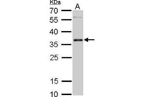 WB Image PIM2 antibody detects PIM2 protein by Western blot analysis.