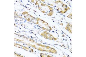 Immunohistochemistry of paraffin-embedded human stomach using LYZ antibody (ABIN5975352) at dilution of 1/100 (40x lens). (LYZ 抗体)