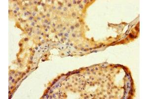 Immunohistochemistry of paraffin-embedded human testis tissue using ABIN7173479 at dilution of 1:100 (TRIM74 抗体  (AA 47-249))