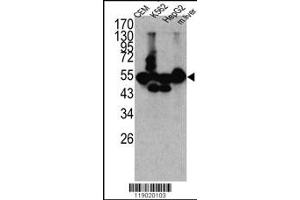 Western blot analysis of CPN1 antibody in K562, CEM, HEpG2 cell line lysates and mouse liver tissue lysates (35ug/lane) (CPN1 抗体  (N-Term))