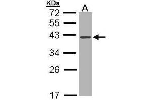 WB Image Sample (30 ug of whole cell lysate) A: MOLT4 , 10% SDS PAGE antibody diluted at 1:1000 (DNASE1 抗体)