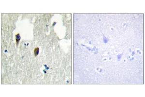 Immunohistochemistry (IHC) image for anti-Kelch-Like 3 (KLHL3) (N-Term) antibody (ABIN1850052) (KLHL3 抗体  (N-Term))