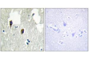 Immunohistochemistry (IHC) image for anti-Kelch-Like 3 (KLHL3) (N-Term) antibody (ABIN1850052) (KLHL3 抗体  (N-Term))