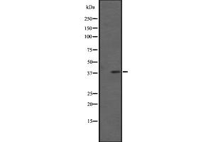 Western blot analysis of FPRL1 expression in Extracts from HL60 cells. (FPR2 抗体  (C-Term))