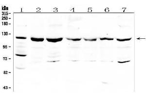 Western blot analysis of RNF31 using anti-RNF31 antibody (ABIN6719368).