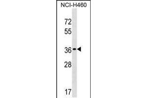 Western blot analysis in NCI-H460 cell line lysates (35ug/lane). (TP53TG5 抗体  (AA 134-161))