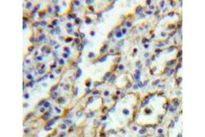 Used in DAB staining on fromalin fixed paraffin-embedded spleen tissue (IL5RA 抗体  (AA 41-203))